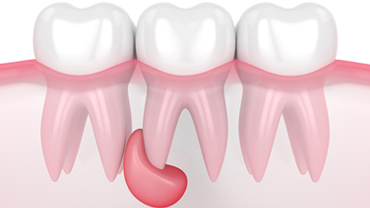 Website Design & Development